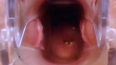 Webcam Pussy Play with Speculum